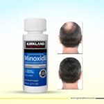 Kirkland 5% Minoxidil – Hair Loss & Hair Regrowth Treatment