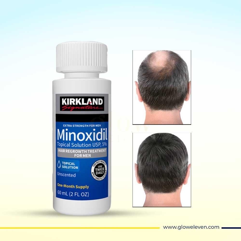 Minoxidil