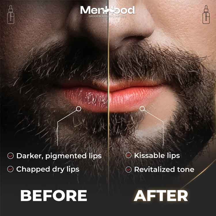 Lip Balm